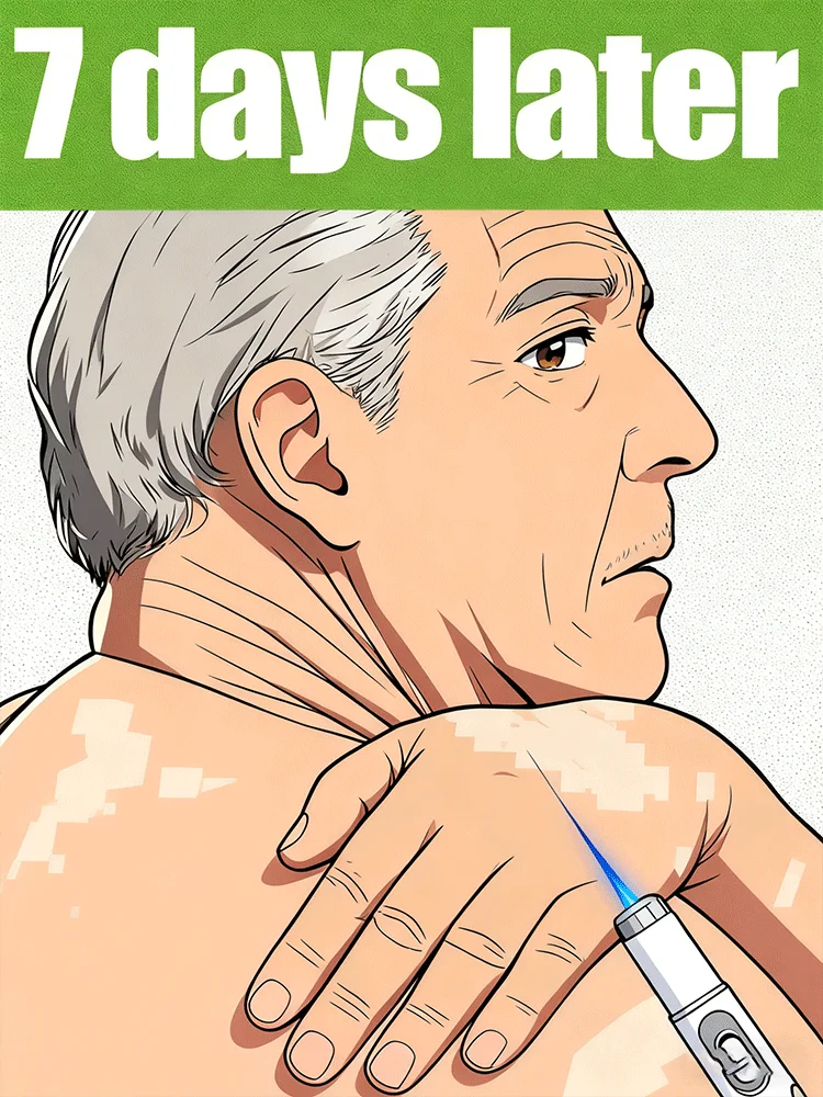 

Vitiligo Treatment Device 2nd Upgraded Version⸴Vitiligo Treatment⸴Fast