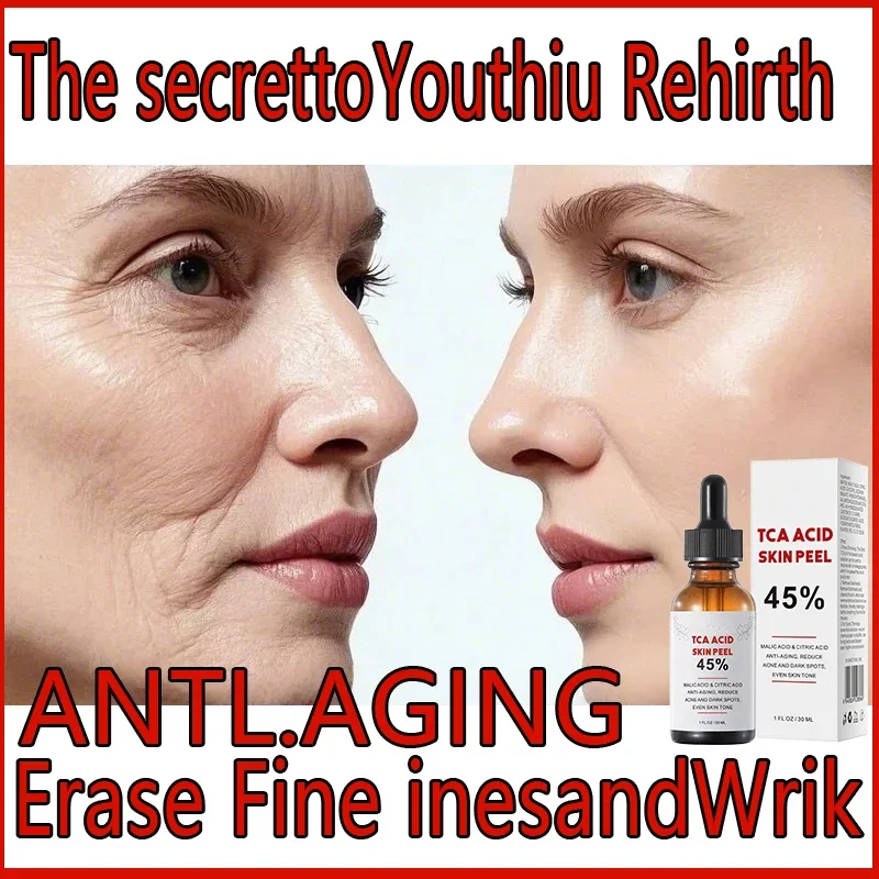 

Tca Acidskin Peel 45% Malic Acid & Citric Acidanti-aging, Reduceacne and Dark Spots,even Skin Tone 1