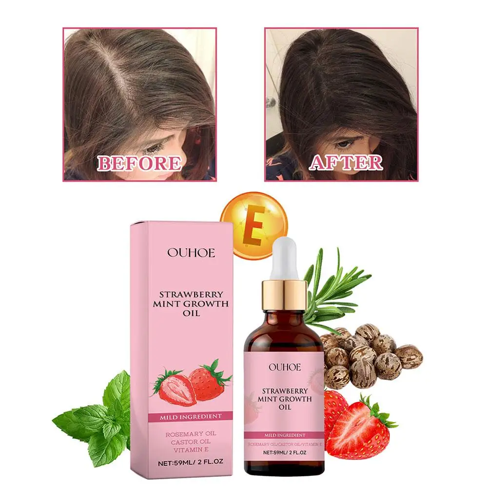 Aardbei Mint Groei Olie Haar Etherische Olie Haarolie Haarverzorging Serum Voor Haar Versterking Voedende Gespleten Haarpunten 59Ml B1i5