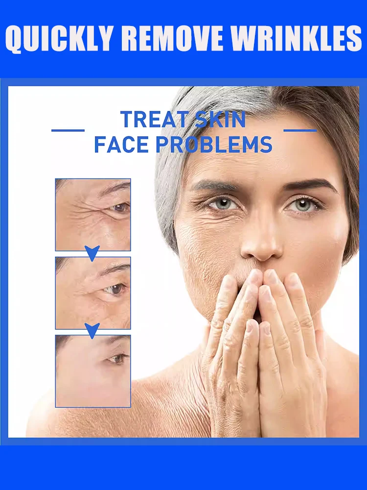 レチノール アンチリンクル クリーム リペア インスタント リンクル ブライトニング リペア シワを消す 引き締め リフティング 軽量スキンケア