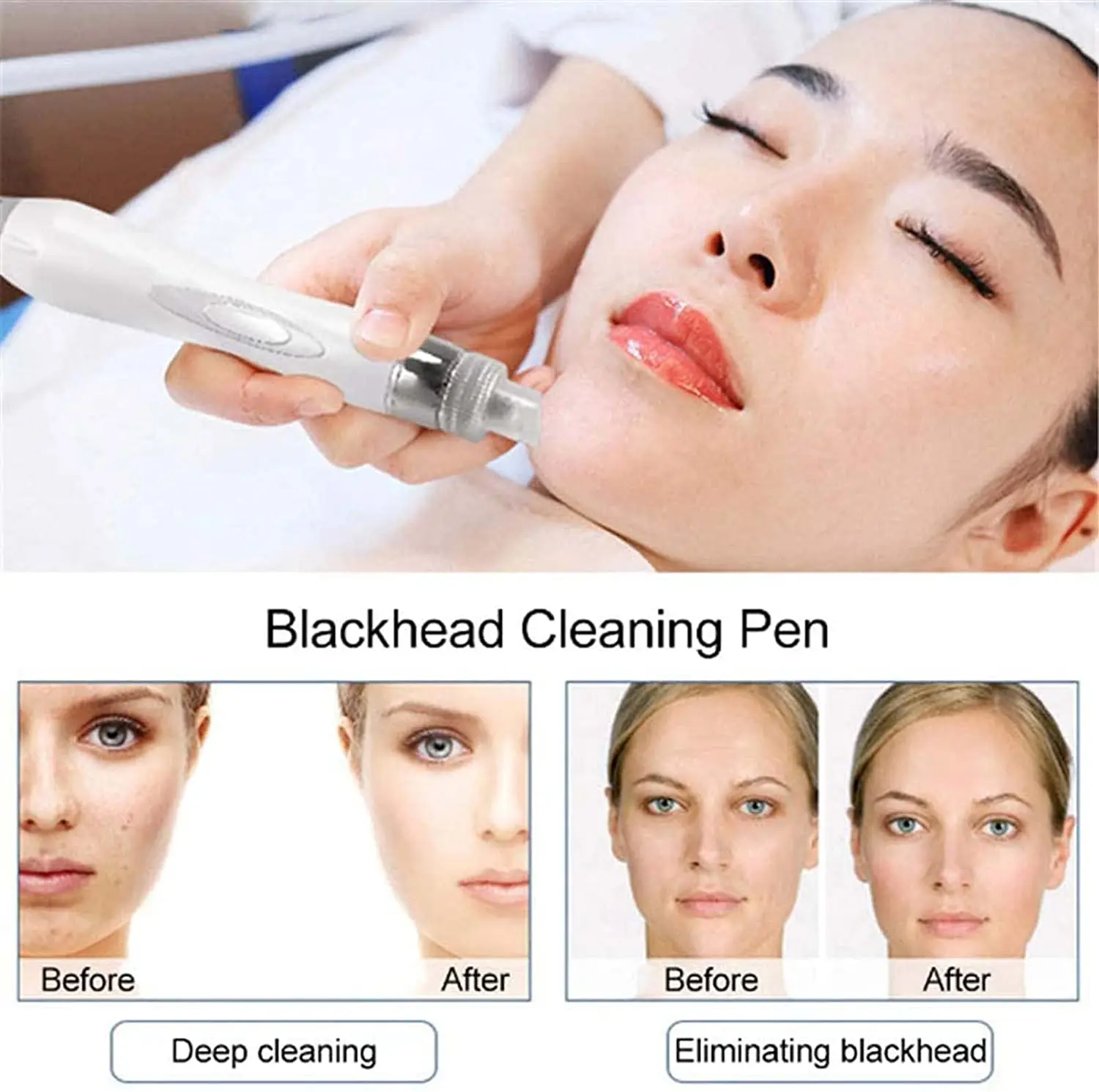 6/7IN1 Hydrogen Oxygen Water Dermabrasion RF Lifting Ance Pore Cleaning Peeling Microdermabrasion Facial Bubble Beauty Machine