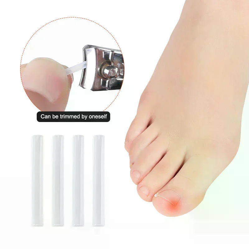 Ensemble d'autocollants professionnels pour correcteur d'ongles incarnés, soins des ongles des orteils, outils de pédicure, soins de santé, protection du traitement Paronychia