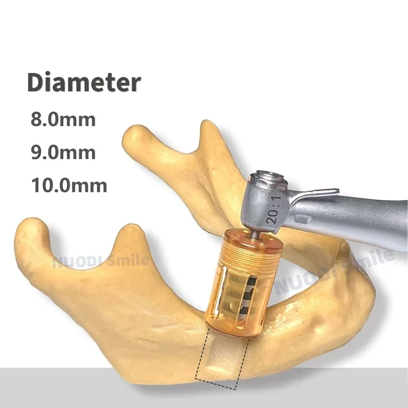 Dental Implant SLT Half Moon Bone Drill Implant Ring Drill Used for Incremental Bone Implantation Surgery To Extract Flake Bone