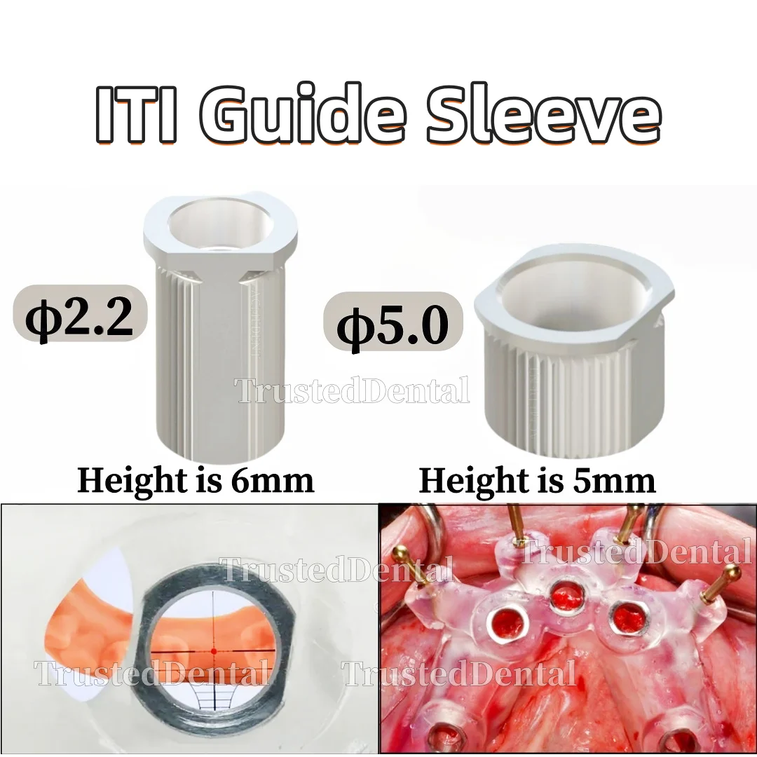 

Dental ITI Guide Hole Sleeve T-Sleeve Guided Digital Guidance Implant Stainless Steel Ø5mm 2.2mm