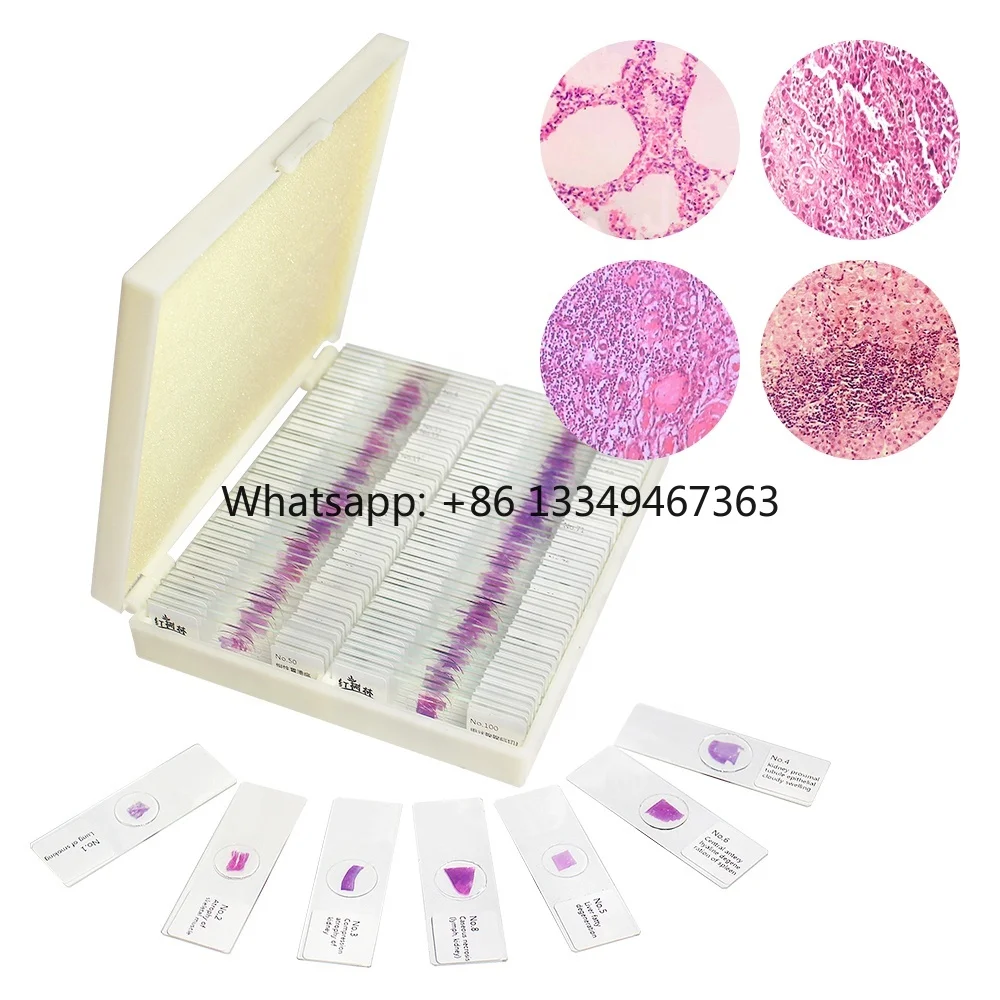 Pathological Slides 100pcs Set  for Student Biological Slides Prepared Pathology Teaching Resources