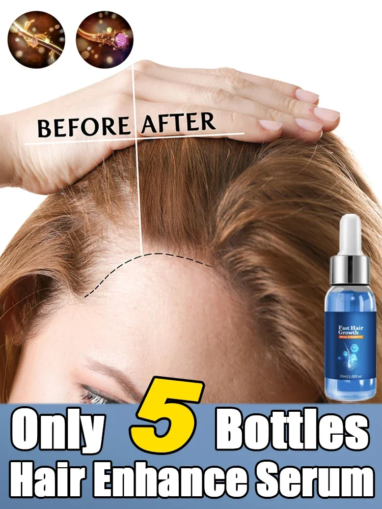 

Powerful Hair Loss Prevention and Scalp Repair Treatment with Nourishing egrowth Fluid Longer Thicker Preventing alopecia 2024