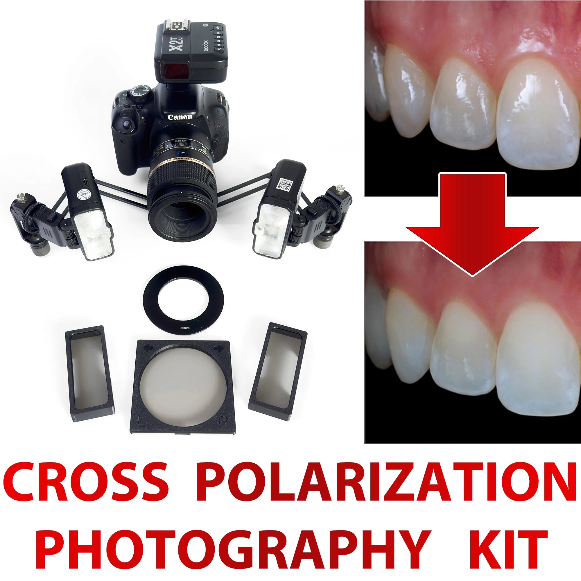 Godox MF12 Flash Cross Polarization Set For Dental Photography - No Reflections, No Glare Polarization Photo Kit For Dentist