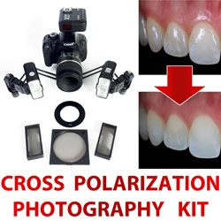 Godox MF12 Flash Cross Polarization Set For Dental Photography - No Reflections, No Glare Polarization Photo Kit For Dentist