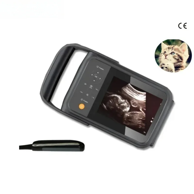 Medical Handheld Scanner Portable Ultrasound Diagnostic System