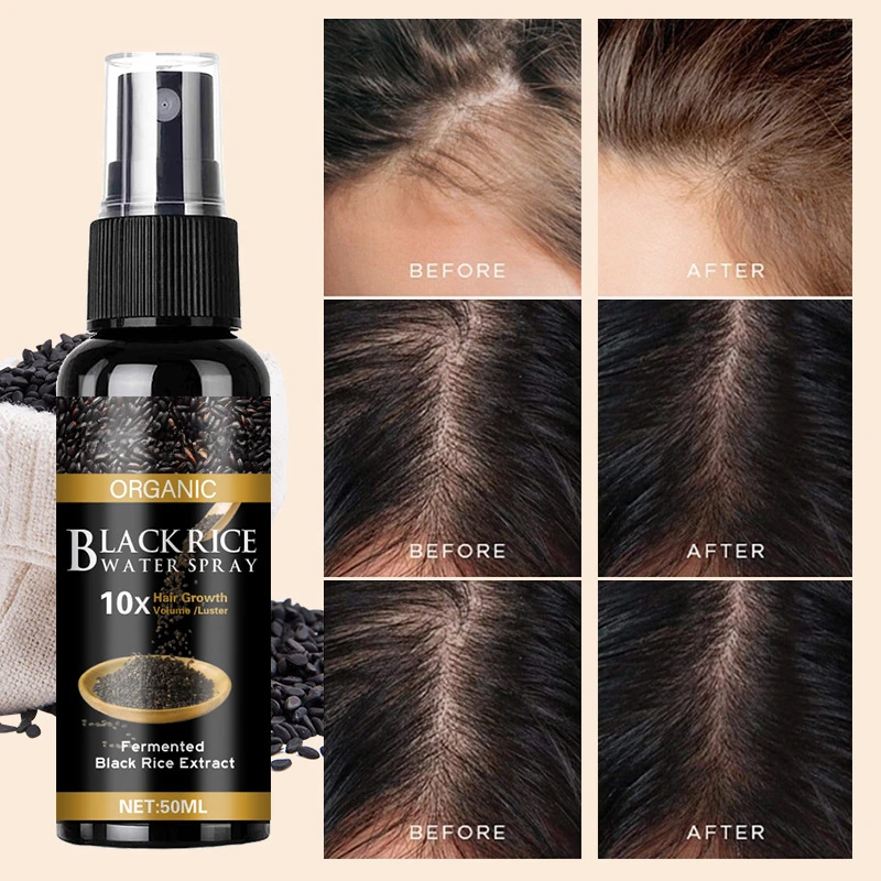 50ml black rice water scalp care solution nourishes hair remove oil prevent hair dryness improves scalp environment hair quality