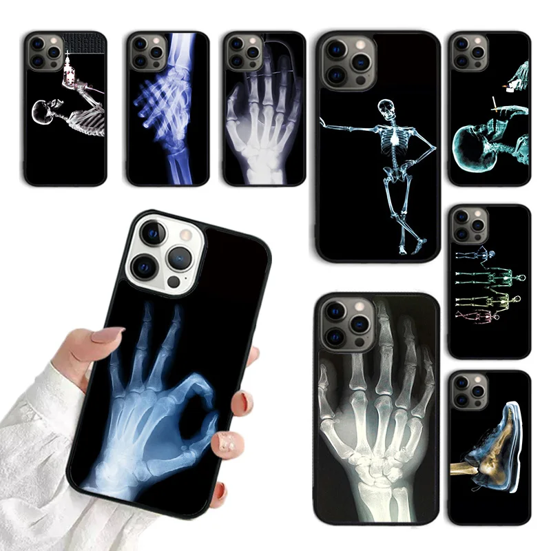 X-ray Hand Bones Phone Case For iPhone 15 16 SE2020 11 12 13 14 Pro Max Mini Cover For iPhone Max 6 7 8 Plus coque Fundas