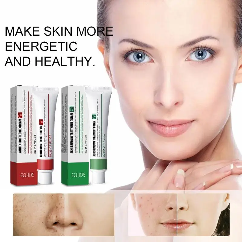 Acne-Removing Spot-Removing Cream Repair Skin Barrier Remove Redness Spot-removing Brightening Skin Moisturizing Cream