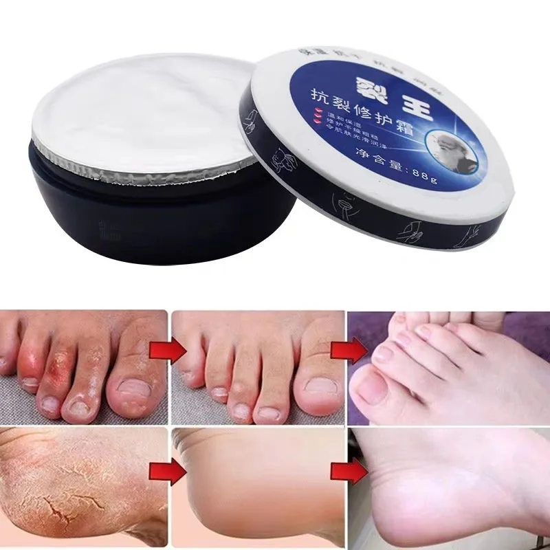 2X88g Traditional Chinese Skin Repair Hand Foot Crack Cream Heel Chapped Peeling Anti Dry Crack Exfoliating Deep Moisturized