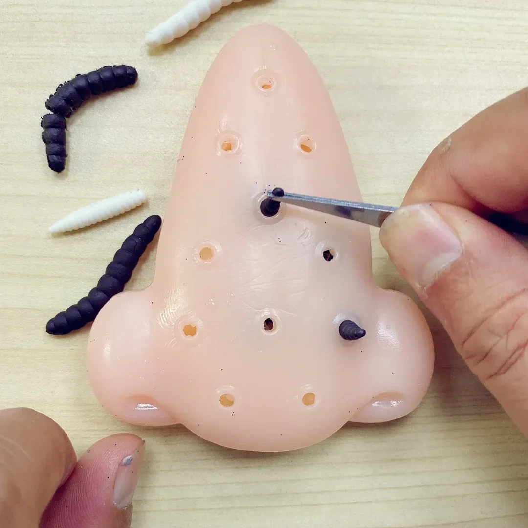 1 pçs espinha popping cravos removedor brinquedo engraçado acne espremendo truque jogo ansiedade alívio brinquedos de descompressão