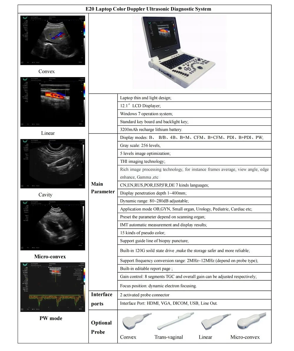 12 Inch LED Laptop Screen 2D Notebook Color Doppler Ultrasonic PC Echo B Ultrasound Diagnostic Scanner Machine