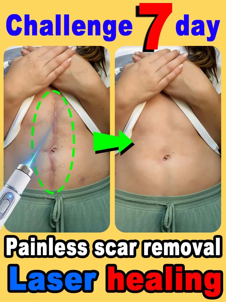 Sin cicatrices, piel lisa.