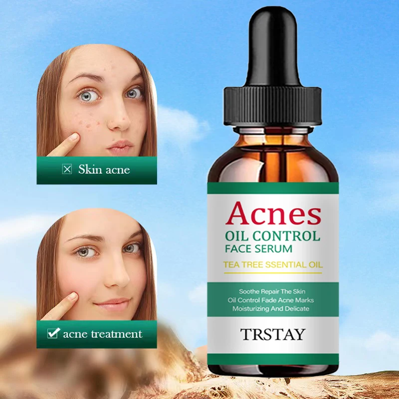 

5ML/15ML/30ML/50ML/Acne Oil Control Facial essence can fade spots, shrink pores, brighten skin tone and control oil