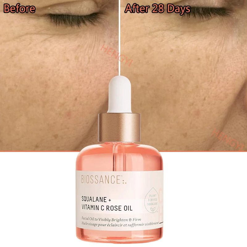 Squalane Vitamin C Rose Oil Removes Wrinkle Antioxidan Smooths Fine Lines Anti Aging Korean Essence Skin Care New Firming Oil