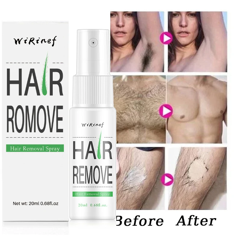 Permanent Hair Removal Spray Fast Hair Growth Inhibition Remove Armpit Legs Arms Painless Depilatory Nourishing Repair Body Care