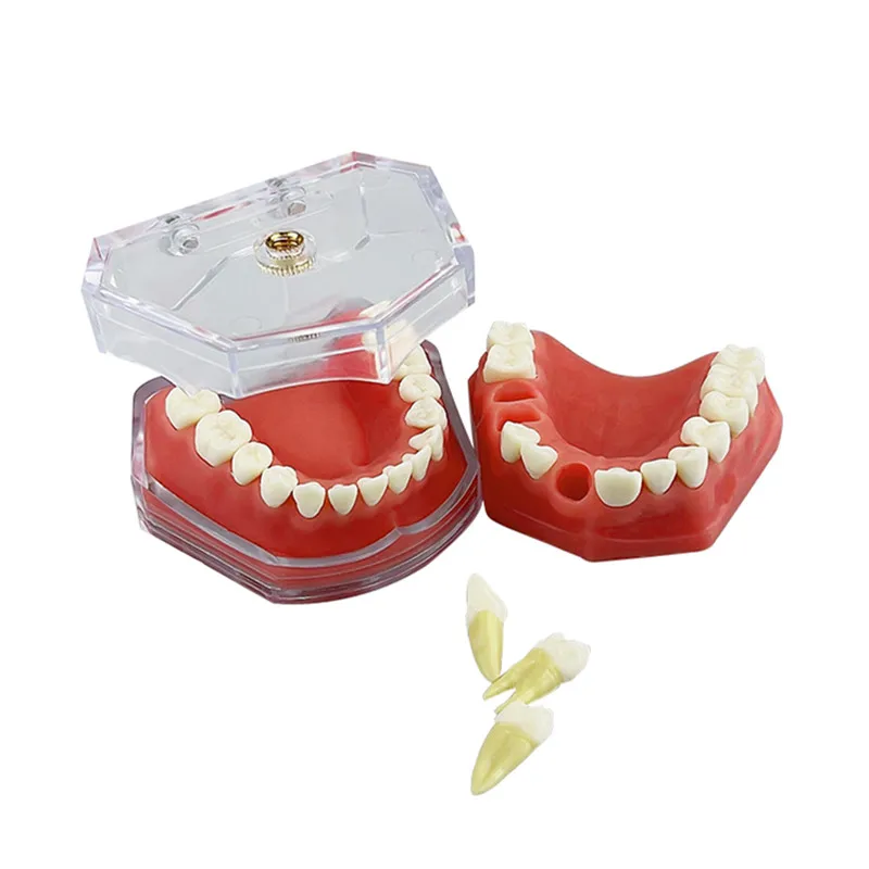 Dental Model With Removable Teeth Standard Jaw Typodont Soft Gum Dental Study Teaching Demonstration Model Dentistry Products