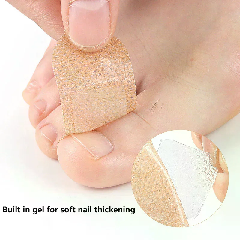 بقع أظافر متعددة الأغراض لأظافر القدم أظافر غير مزعجة وقابلة للتنفس مقاومة للماء أداة العناية بالقدم