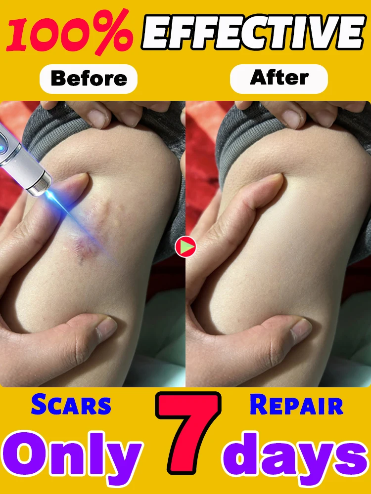 

Transform your skin in 7 days