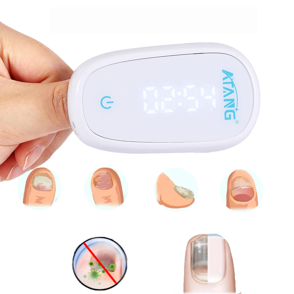 

Anti Fungal Infection Laser Device 905nm 470nm Home Nail Laser Treatment Device for Nail Fungus Infection Onychomycosis Cure