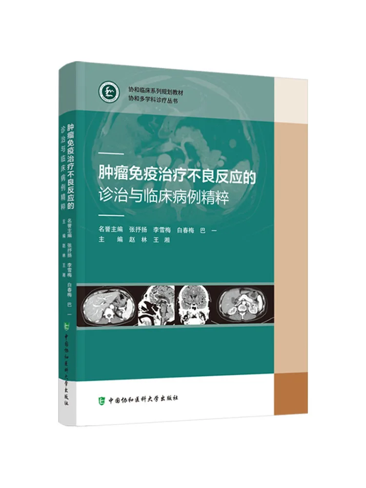 Book-Winshare Management and Treatment Of Adverse Reactions To Tumor Immunotherapy and Clinical Case Studies