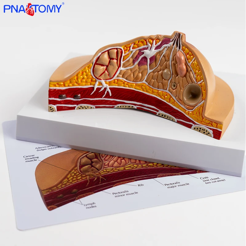 

Breast Anatomy Model Teaching Aids Female Breast Structure Medical Beauty Salon Props Pathology Breast Dissection Teaching Gift