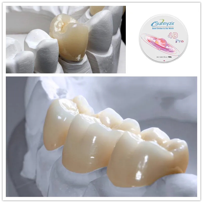 Sunnyzir 4D Plus/Pro Multilayer Dental Zirconia For Open CAD/CAM Milling System in Dental Lab Dental Material Zirconium Disc