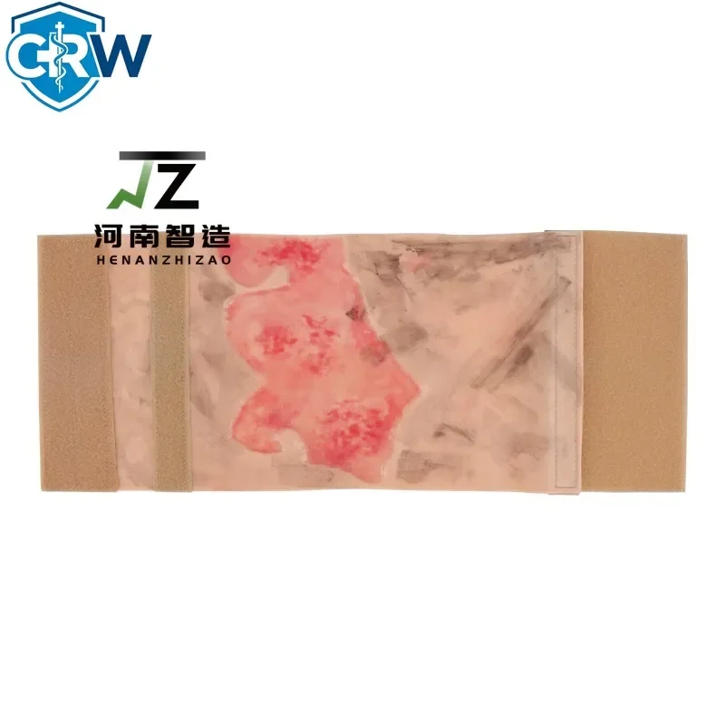 CRW Bestselling Wearable 2-3 Degree Limb Burns Training Module High Simulation Limb Burn Model Medical Student Nurse Training