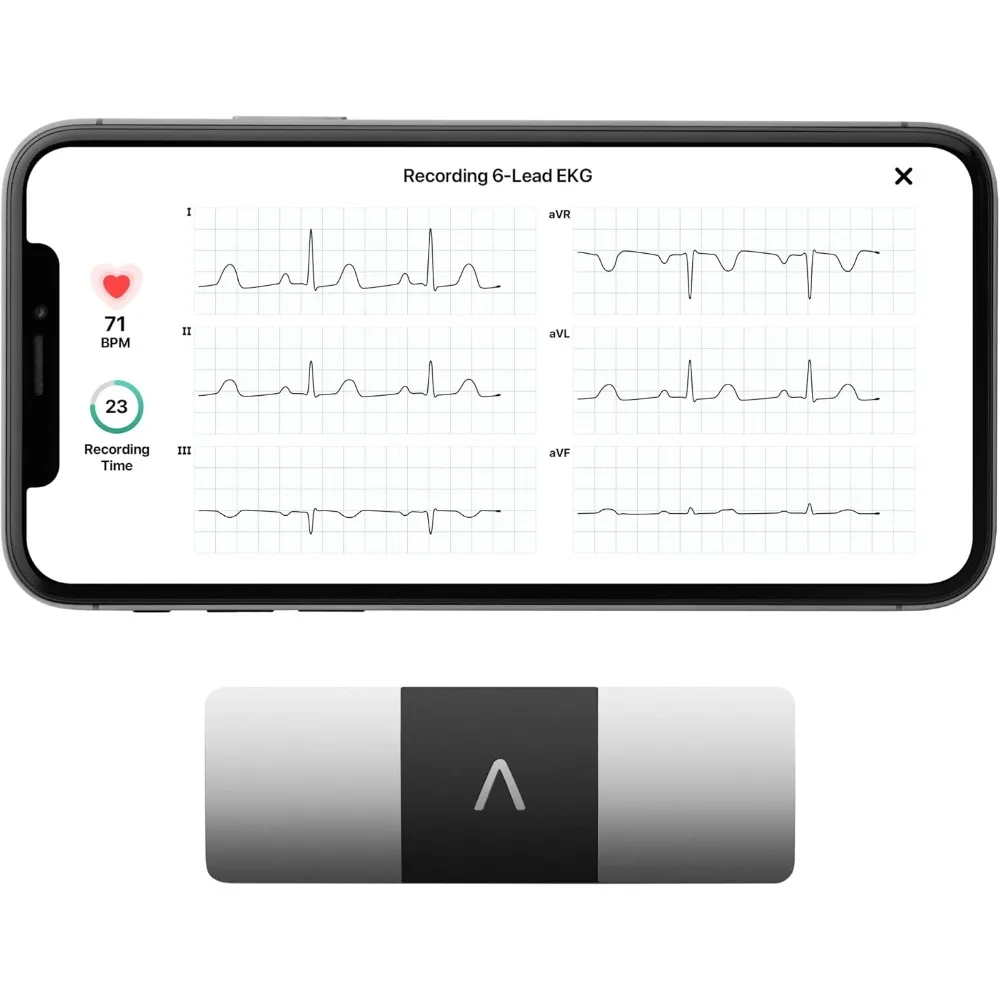 6-Lead Personal EKG Monitor – Six Views of The Heart – Detects AFib and Irregular Arrhythmias – Instant Results in 30 Seconds