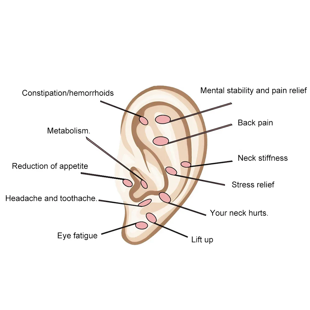 Kit d'autocollants auriculaires d'acupuncture de graines d'oreille 100 pièces graines d'oreille avec tableau d'oreille d'acupression titane perle blanc pince à épiler thérapie TCM