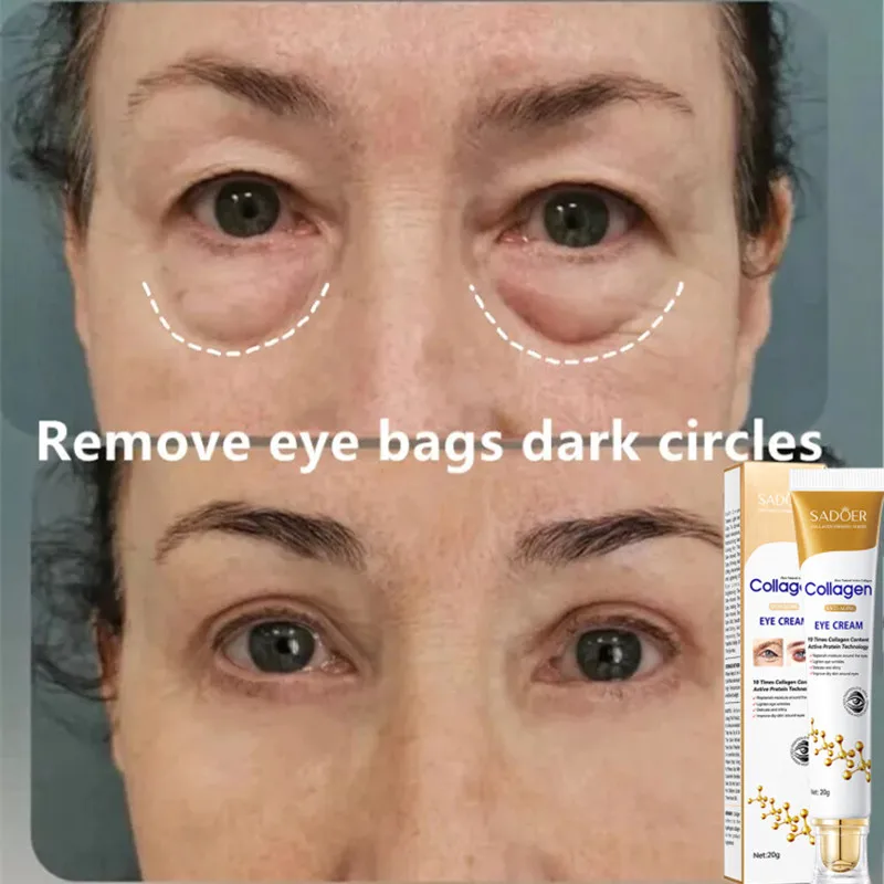 

Collagen Eye Cream Wrinkle Eye Bag Dark Circle Remover Cream Anti Puffiness Gel Delays Aging Firming Brighten Skin Unisex