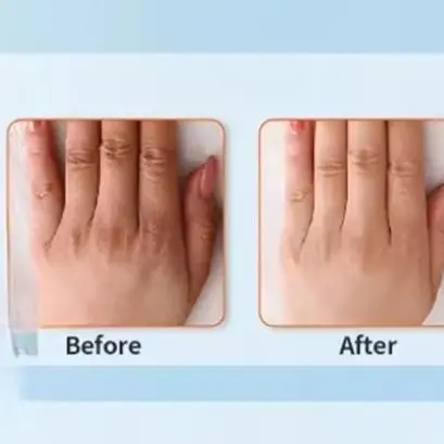 

Red Light Promote Blood Circulation for Hand Near Infrared Mitten for Arthritis Fingers Glove Wholesale