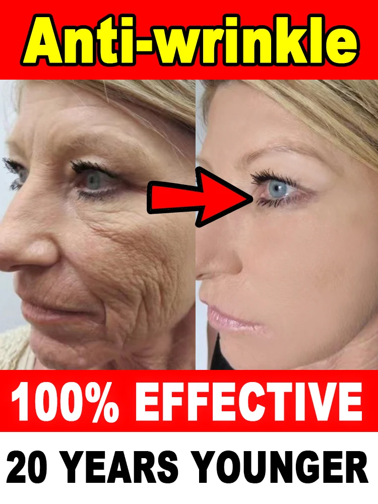 

Wrinkles disappear