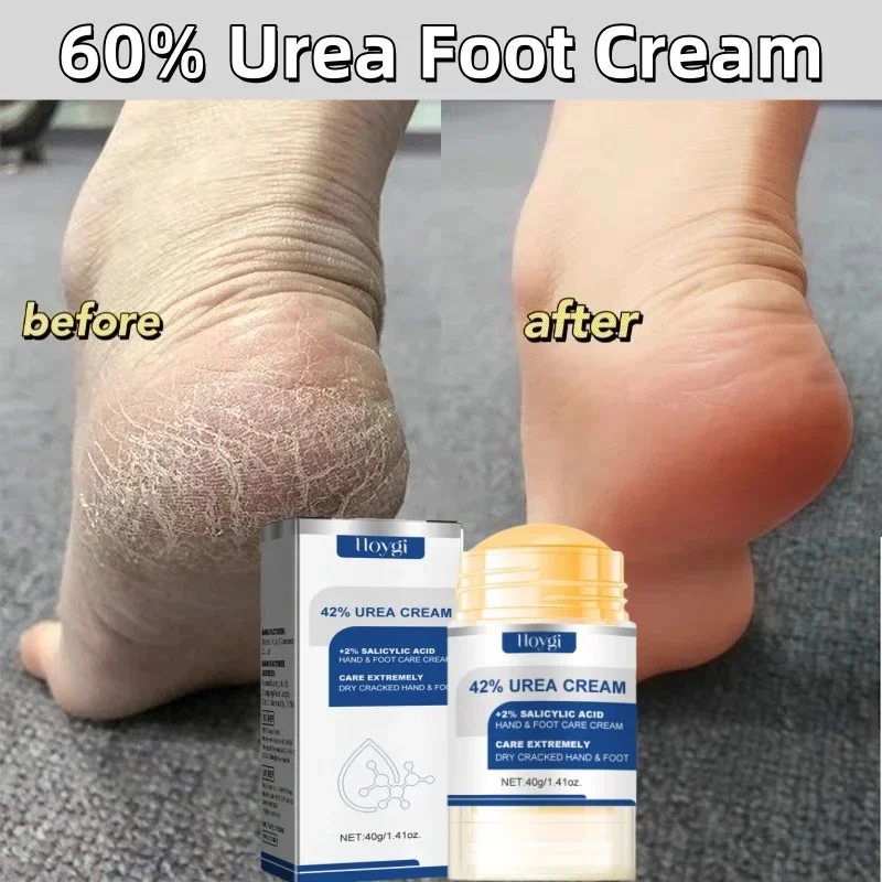 60% Urea Foot Cream Aloe Vera Ultra-hydrating Softening Dry Cracked Feet Cream Gentle Exfoliation Daily Foot Care Solution 40g