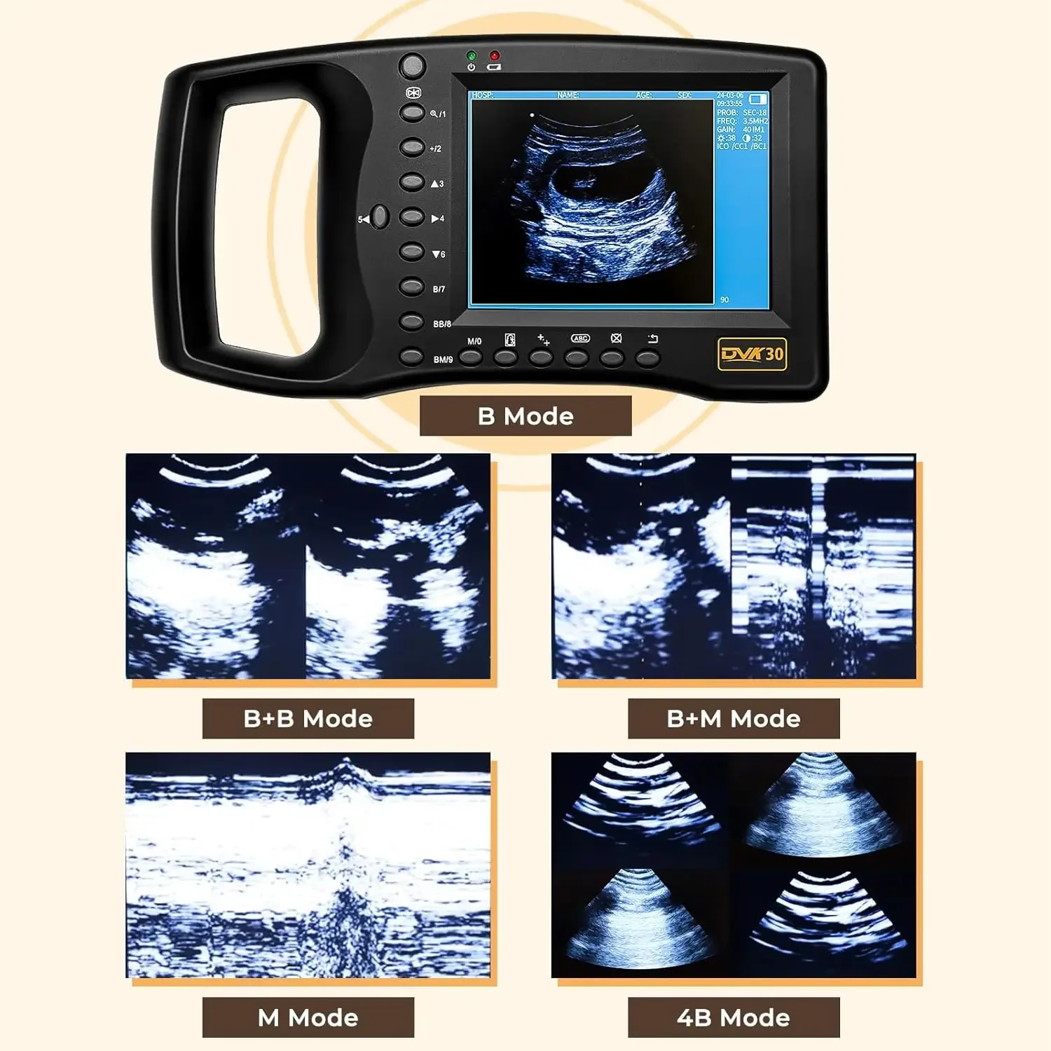 Handheld Ultrasound Machine for Pregnancy Horse & Cows and Other Large Animals - Portable Veterinary Ultrasound Machine