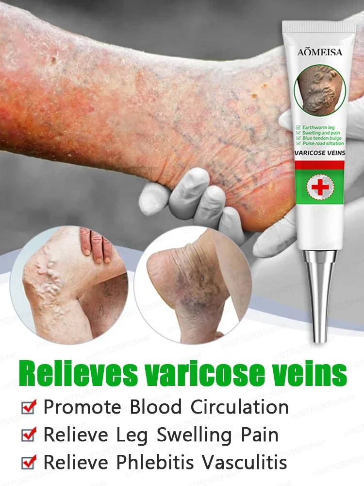 Gel to relieve varicose veins, relieve lumps in legs