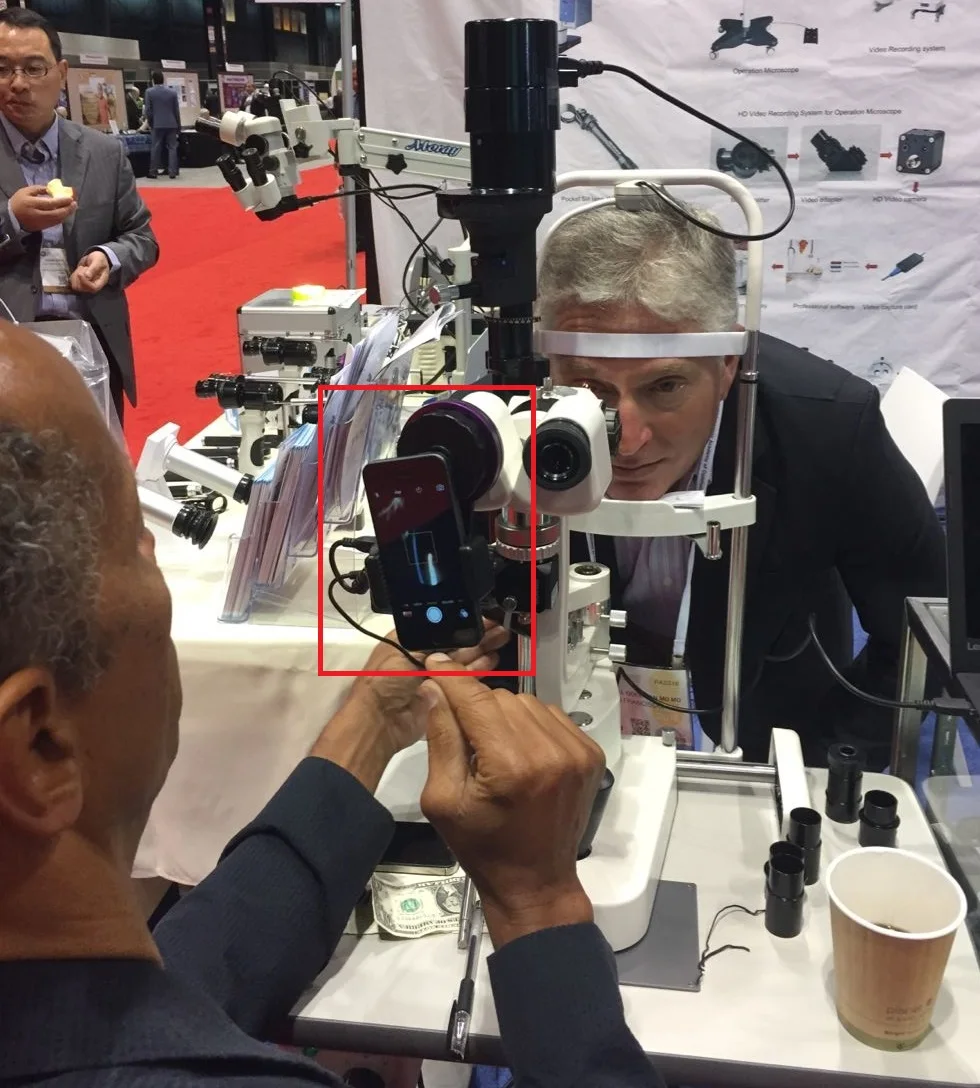 Spleetlamp Microsocpe-adapter voor iPhone