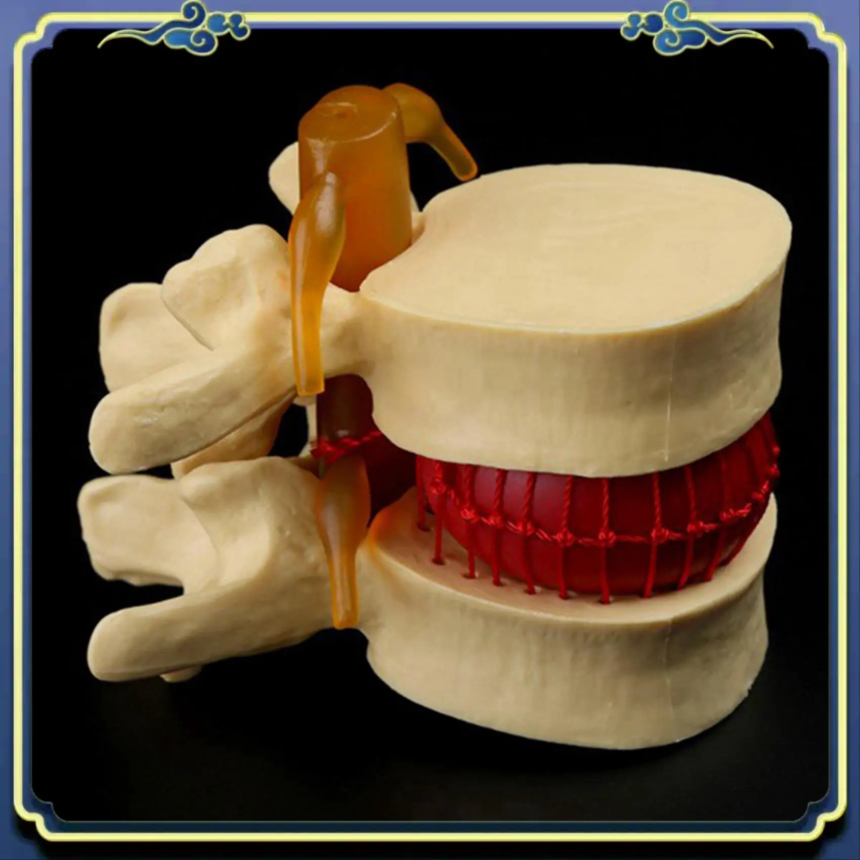 Portable 2X Lumbar Vertebrae Model Anatomical Spine Lumbar Disc Herniation Anatomy Teaching Tool Lumbar Vertebrae Model