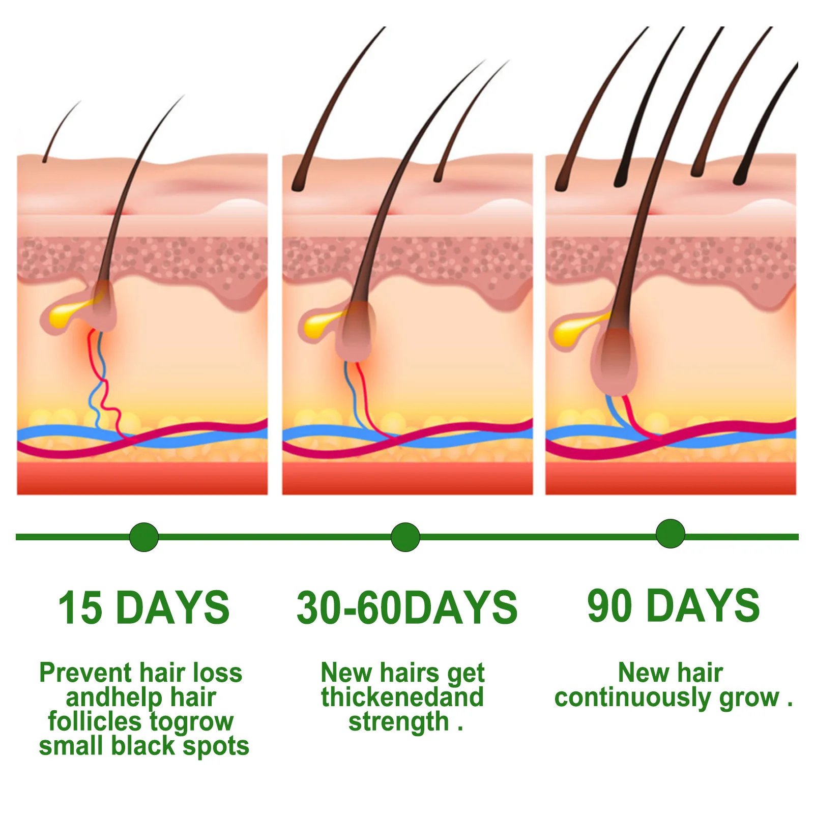 EELHOE Rosemary Oil Hair Growth Products Anti Hair Loss Treatment for Damaged Hair Care Soft Smooth Rosemary Essential Oil 30ml image 6