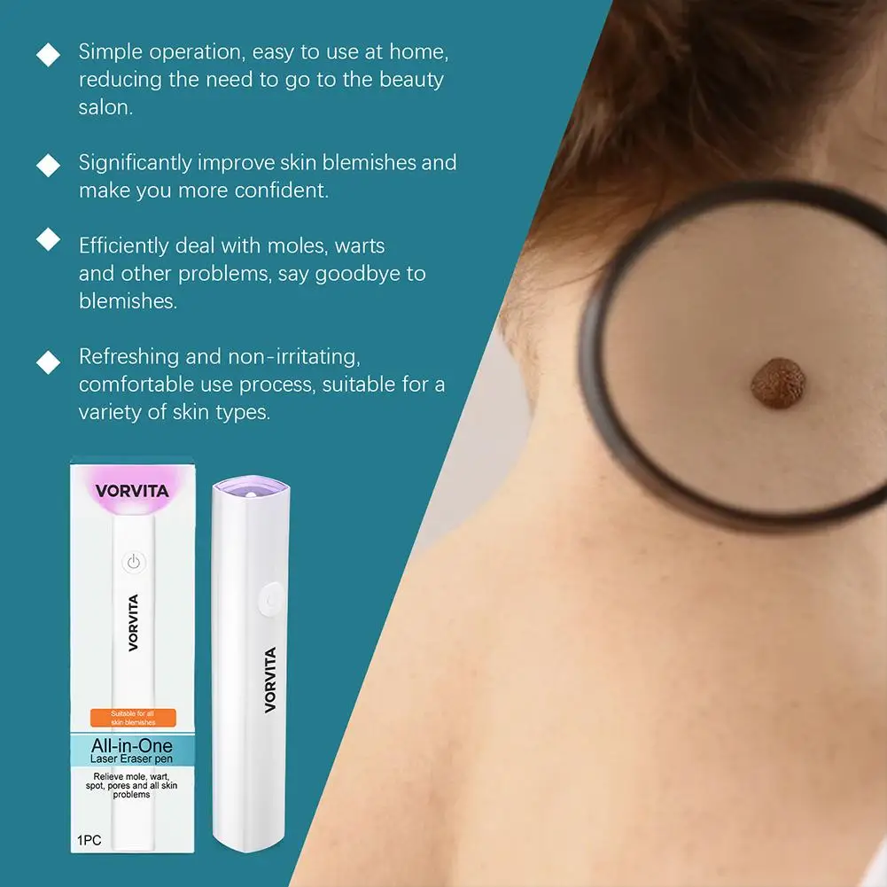 قلم بلازما ليزر احترافي ذو نقطة تجميد الضوء الأزرق آلة إزالة الشامات آلة تسمية ثؤلول الوجه تجميل الرؤوس السوداء #3