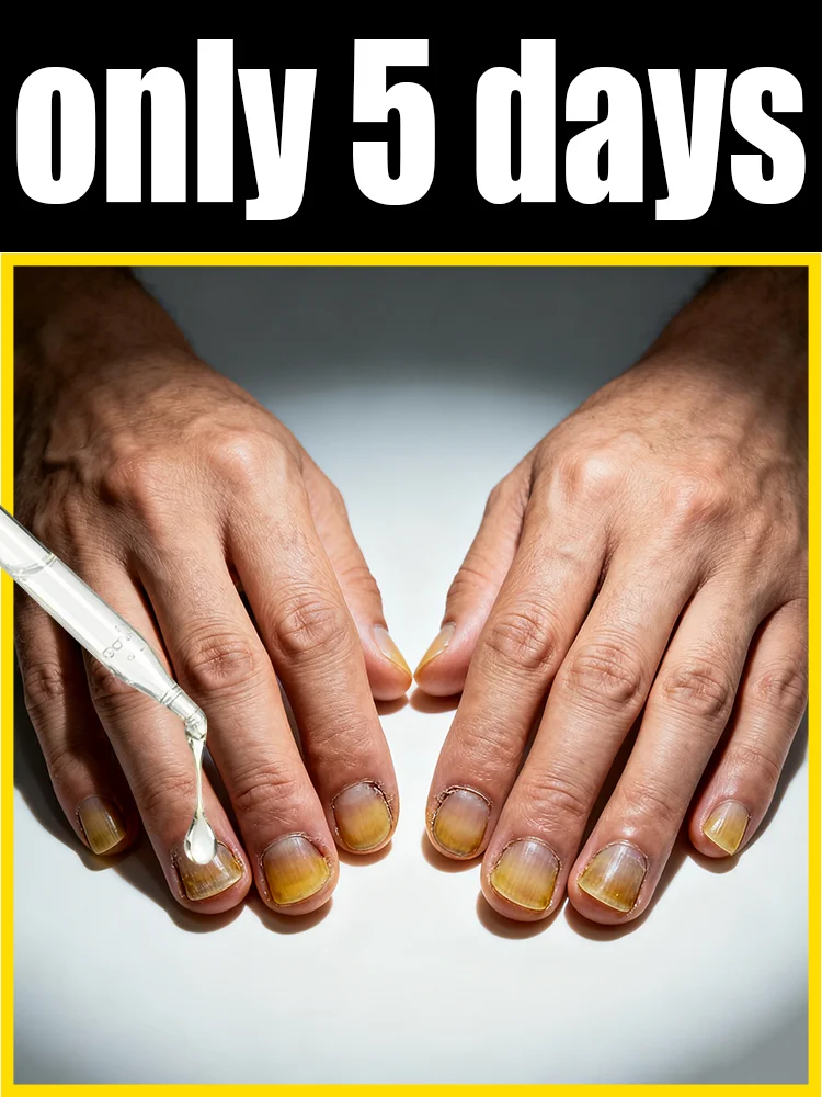 

Say Goodbye to Yellow Dullness, Grow Shiny Nails