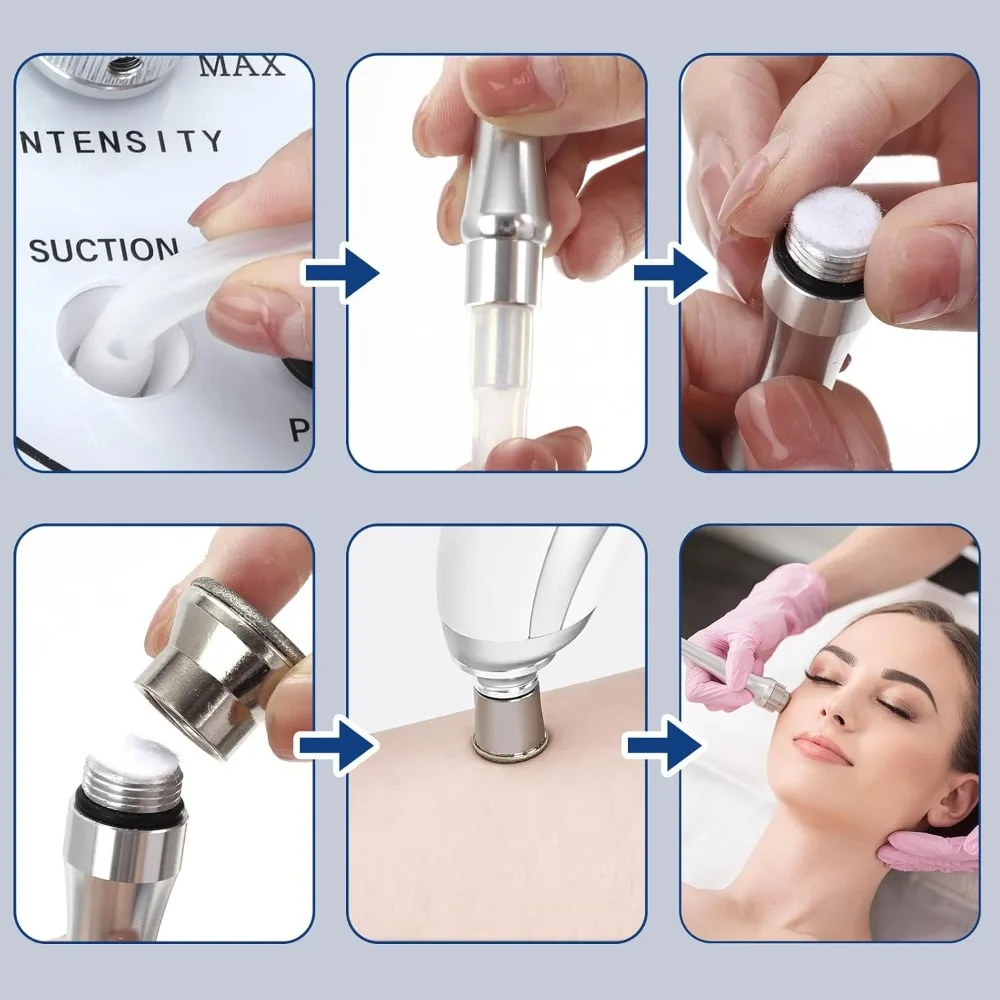 6-9 Spitzen Diamant-Dermabrasionskopf Mikrodermabrasions-Exfoliator Gesichts-Dermabrasionsgerät für Zuhause Dermabrasions-Ersatzköpfe – Detail 3