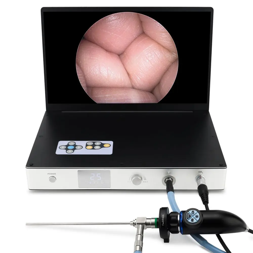 15.6 Inch 4 in 1 Portable Endoscope Camera System With Cold Light Source for Arthroscope Hysteroscopy ENT Veterinary Gynecology