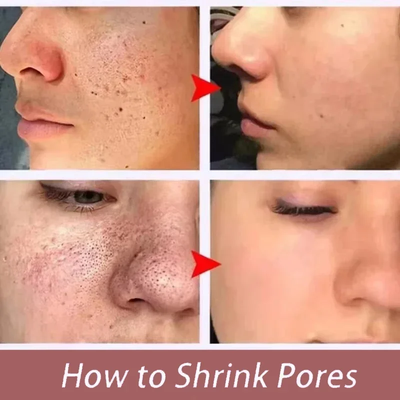 Feels Like Silk, Looks Like Filter. Salicylic Acid Pore Serum – Tightens, Minimizes, Firms, Smooths Enlarged Pores – Korean