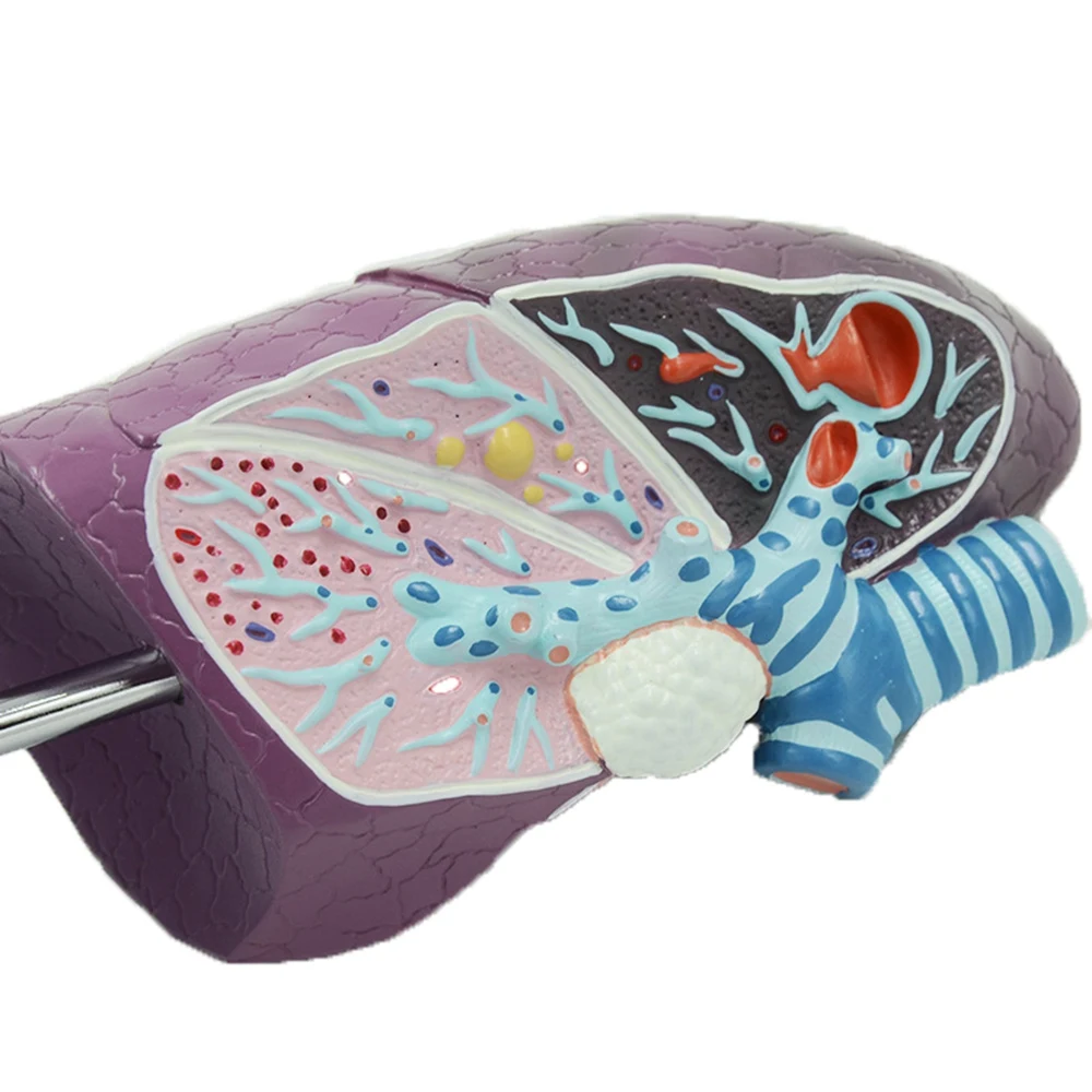 Human Lung Model Pathological Lung Anatomy Model Human Organ Model for Doctors Office Educational Tool