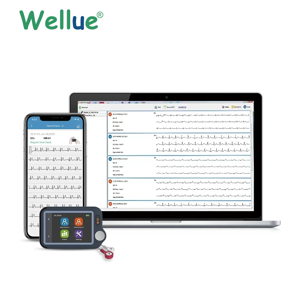 

2025/ Pulsebit Lead I Lead Ii Chest Lead Electrodos Ppg Sensors Mini Holter Recorder Portable Electrocardiograph