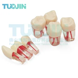 5PCS Dental Tooth Model Endodontic Root Canal Block RCT Practice Pulp Cavity Dentistry Replace Resin Teeth Endo Training Student